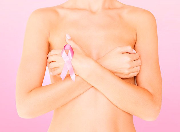 Paciente lista para una reconstrucción mamaria por cáncer de mama
